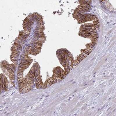 Immunohistochemistry-Paraffin: CD38 Antibody [NBP2-38668]