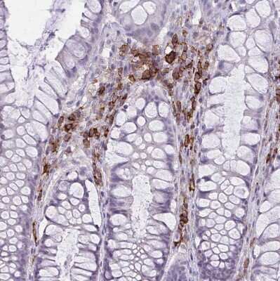 Immunohistochemistry-Paraffin: CD38 Antibody [NBP2-38668]