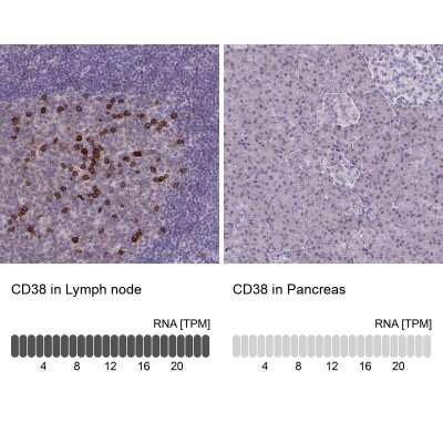 Immunohistochemistry-Paraffin: CD38 Antibody [NBP2-38668]