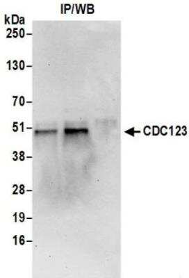 Immunoprecipitation: CD38 Antibody (BLR123H) [NBP3-14707]