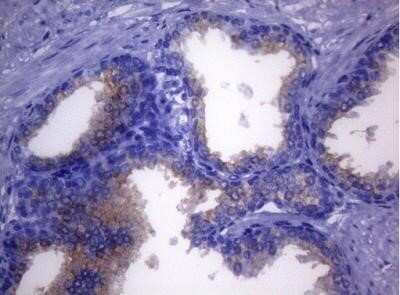 Immunohistochemistry: CD38 Antibody (OTI1C9) - Azide and BSA Free [NBP2-70376]