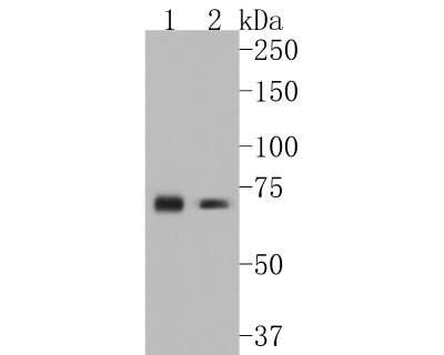 Western Blot: CD39/ENTPD1 Antibody (JA90-36) [NBP2-67230]