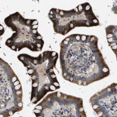 Immunohistochemistry-Paraffin: CD39L1/ENTPD2 Antibody [NBP1-85752]
