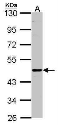 Western Blot: CD39L2/ENTPD6 Antibody [NBP1-32294]