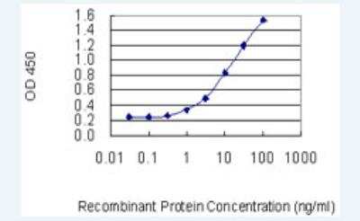 ELISA: CD39L3/ENTPD3 Antibody (3E8) [H00000956-M01-100ug]