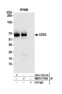 Immunoprecipitation: CD4 Antibody (BL-155-1C11) [NBP2-76423]