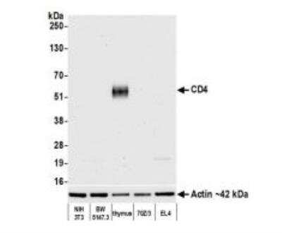 Western Blot: CD4 Antibody (BLR167J) [NBP3-14741]