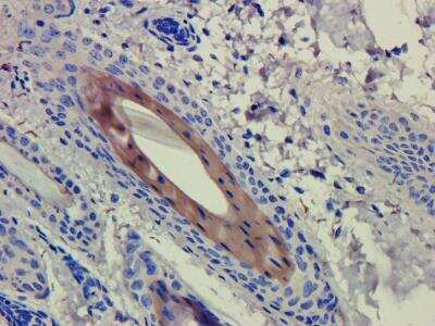 Immunohistochemistry: CD4 Antibody (CE9.1 (Clenoliximab)) - Azide and BSA Free [NBP2-75910]