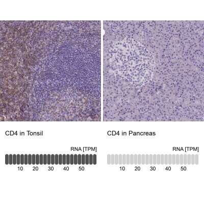 Immunohistochemistry-Paraffin: CD4 Antibody (CL0395) [NBP2-52928]