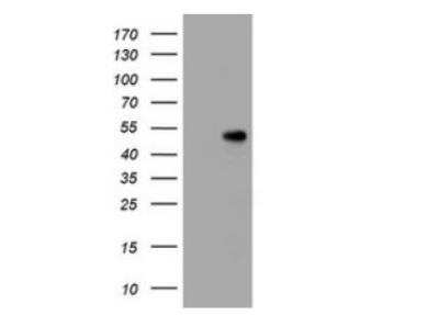 Western Blot: CD4 Antibody (OTI5D9)Azide and BSA Free [NBP2-70357]