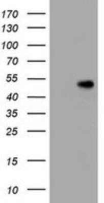 Western Blot: CD4 Antibody (OTI5D9) [NBP2-46149]