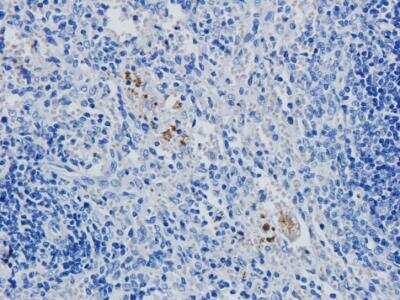 Immunohistochemistry: CD4 Antibody (YNB46.1.8 (Campath-9H)) - Azide and BSA Free [NBP2-75900]
