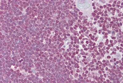 Immunohistochemistry-Paraffin: CD40 Ligand/TNFSF5 Antibody [NBP1-59186]