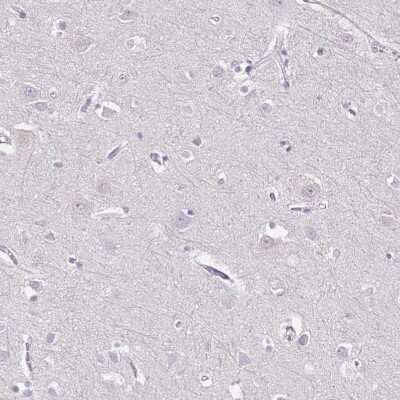 Immunohistochemistry-Paraffin: CD40 Ligand/TNFSF5 Antibody [NBP1-91770]
