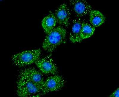 Immunocytochemistry/ Immunofluorescence: CD40 Ligand/TNFSF5 Antibody (JM11-34) [NBP2-66756]