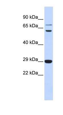Western Blot: CD40 Ligand/TNFSF5 Antibody [NBP1-59186]