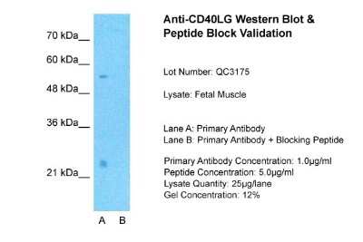 Western Blot: CD40 Ligand/TNFSF5 Antibody [NBP1-59186]