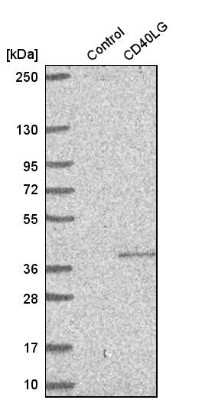 Western Blot: CD40 Ligand/TNFSF5 Antibody [NBP1-91770]