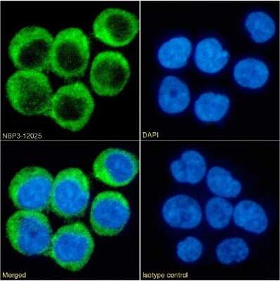 Immunocytochemistry/ Immunofluorescence: CD40 Ligand/TNFSF5 Antibody (chi220) - Chimeric - Azide and BSA Free [NBP3-12025]