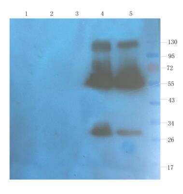 Western Blot: CD40 Ligand/TNFSF5 Antibody (hu5c8 (Ruplizumab))Azide and BSA Free [NBP2-75907]