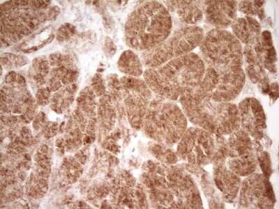 Immunohistochemistry: CD40/TNFRSF5 Antibody (OTI8B8) [NBP2-46150]