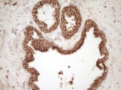 Immunohistochemistry: CD40/TNFRSF5 Antibody (OTI8B8) [NBP2-46150]