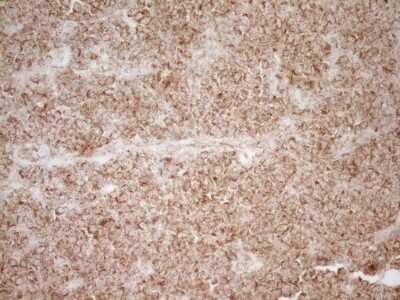 Immunohistochemistry: CD40/TNFRSF5 Antibody (OTI8B8) [NBP2-46150]