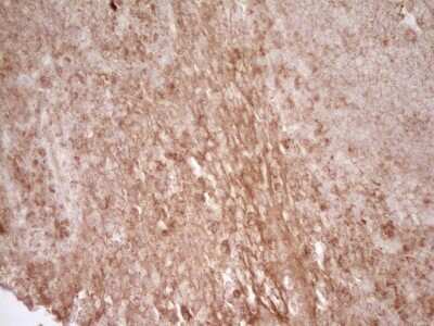 Immunohistochemistry: CD40/TNFRSF5 Antibody (OTI8B8) [NBP2-46150]