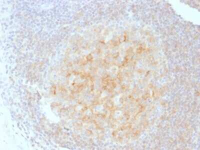 Immunohistochemistry-Paraffin: CD40/TNFRSF5 Antibody (C40/1605) - Azide and BSA Free [NBP2-54502]