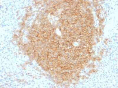 Immunohistochemistry-Paraffin: CD40/TNFRSF5 Antibody (C40/1605) - Azide and BSA Free [NBP2-54502]