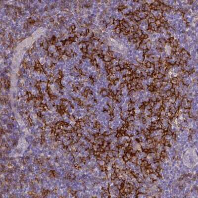 Immunohistochemistry-Paraffin: CD40/TNFRSF5 Antibody (CL1673) [NBP2-34488]