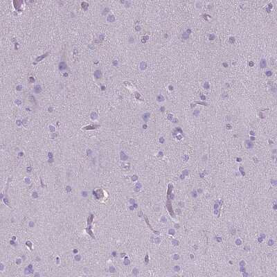 Immunohistochemistry-Paraffin: CD40/TNFRSF5 Antibody (CL1673) [NBP2-34488]