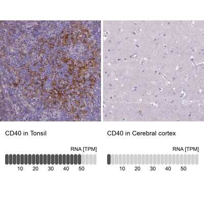 Immunohistochemistry-Paraffin: CD40/TNFRSF5 Antibody [NBP2-33956]