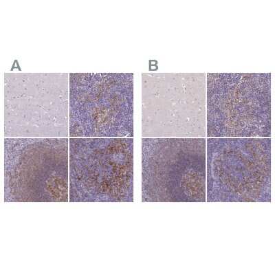 Immunohistochemistry-Paraffin: CD40/TNFRSF5 Antibody [NBP2-33956]