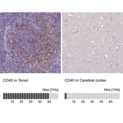 Immunohistochemistry-Paraffin: CD40/TNFRSF5 Antibody [NBP2-33957]