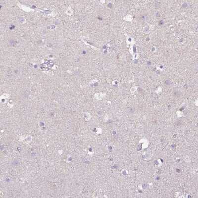 Immunohistochemistry-Paraffin: CD40/TNFRSF5 Antibody [NBP2-33957]