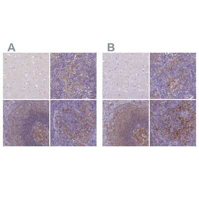 Immunohistochemistry-Paraffin: CD40/TNFRSF5 Antibody [NBP2-33957]