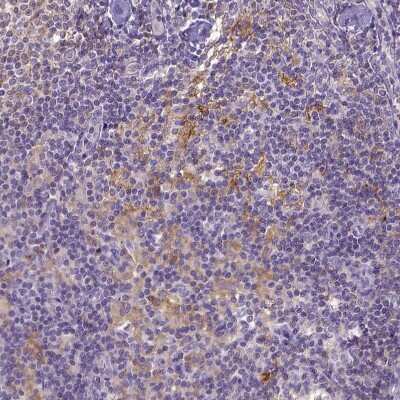 Immunohistochemistry-Paraffin: CD40/TNFRSF5 Antibody [NBP2-33957]