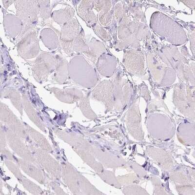 Immunohistochemistry-Paraffin: CD40/TNFRSF5 Antibody [NBP2-33957]