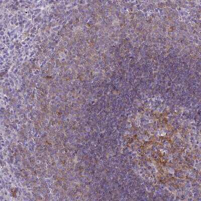 Immunohistochemistry-Paraffin: CD40/TNFRSF5 Antibody [NBP2-33957]