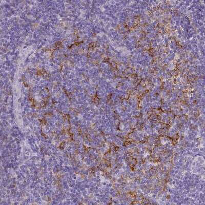 Immunohistochemistry-Paraffin: CD40/TNFRSF5 Antibody [NBP2-33957]
