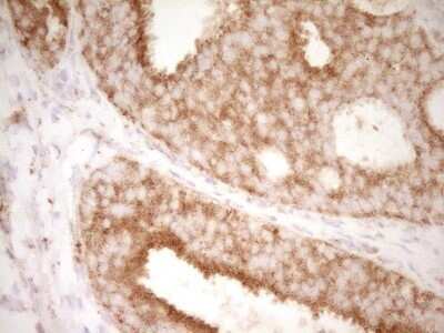 Immunohistochemistry: CD40/TNFRSF5 Antibody (OTI8B8) - Azide and BSA Free [NBP2-70378]