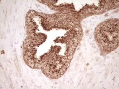 Immunohistochemistry: CD40/TNFRSF5 Antibody (OTI8B8) - Azide and BSA Free [NBP2-70378]