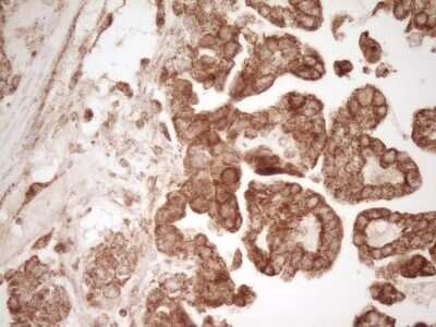 Immunohistochemistry: CD40/TNFRSF5 Antibody (OTI8B8) - Azide and BSA Free [NBP2-70378]