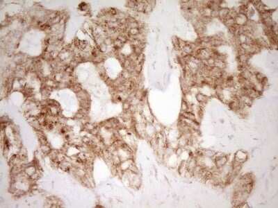 Immunohistochemistry: CD40/TNFRSF5 Antibody (OTI8B8) - Azide and BSA Free [NBP2-70378]