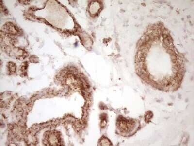 Immunohistochemistry: CD40/TNFRSF5 Antibody (OTI8B8) - Azide and BSA Free [NBP2-70378]