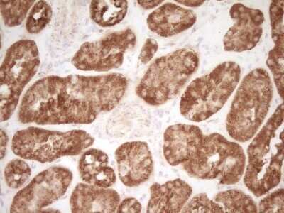 Immunohistochemistry: CD40/TNFRSF5 Antibody (OTI8B8) - Azide and BSA Free [NBP2-70378]