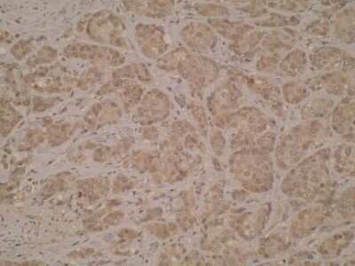 Immunohistochemistry: CD40/TNFRSF5 Antibody (T8P2G4*A6) - BSA Free [NBP2-50284]