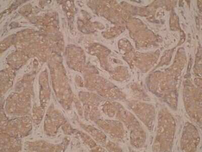 Immunohistochemistry-Paraffin: CD40/TNFRSF5 Antibody (T8P2G4*A6) - BSA Free [NBP2-50284]