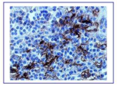 Immunohistochemistry: CD40/TNFRSF5 Antibody (mAb89) [DDX0131P-100]